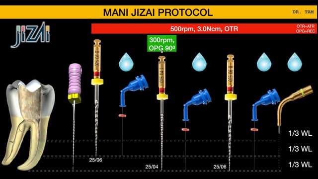 Điều Trị Tủy Răng Và Hàn Kín Hệ Thống Ống Tủy Bằng Gutta Percha Nóng Chảy